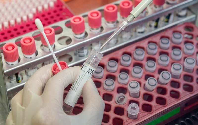 Инфекционист оценил сроки ослабления коронавируса