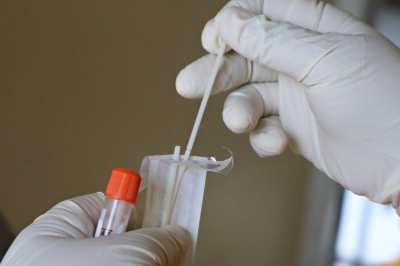 Российский иммунолог рассказал о пропаже антител у переболевших COVID-19