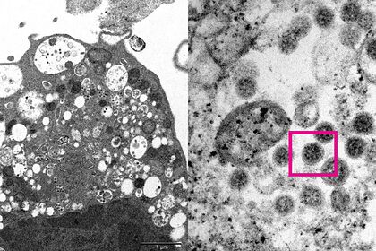 Ученым удалось сфотографировать омикрон-штамм коронавируса